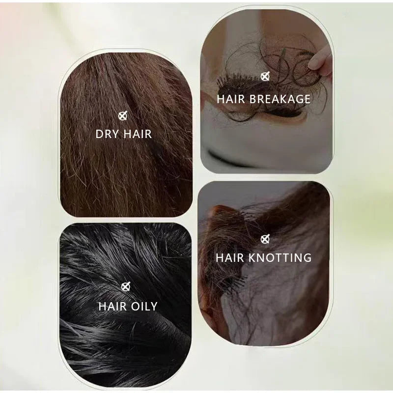 Șampon Solid Natural din Plante – Antimătreață, Anti-Cădere, Calmează Scalpului, Stimulează Creșterea Părului – Handmade