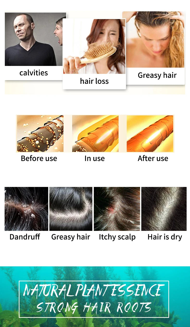 Șampon Solid Ocean – Curățare Profundă, Îndepărtare Sebum, Eliminare Mătreață, Sare de Mare, Formulă pe Bază de Plante, Revigorant & Purifiant