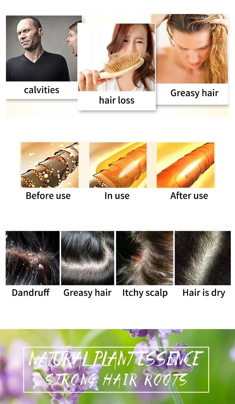 Șampon Solid cu Lavandă – Control Sebum, Purificare Profundă, Calmare Scalp, Fără Silicon, Păr Curat & Neted