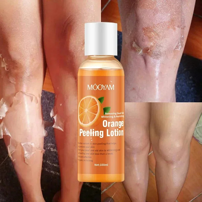 Loțiune Exfoliantă cu Portocală – Peeling pentru Corp, Îndepărtarea Celulelor Moarte, Hidratare și Catifelare